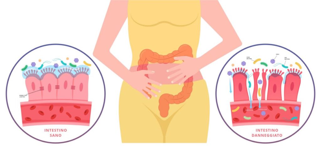 intestino sano a sinistra e intestino permeabile a destra